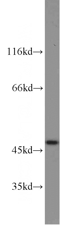 human brain tissue were subjected to SDS PAGE followed by western blot with Catalog No:111517(HOMER1 antibody) at dilution of 1:1000