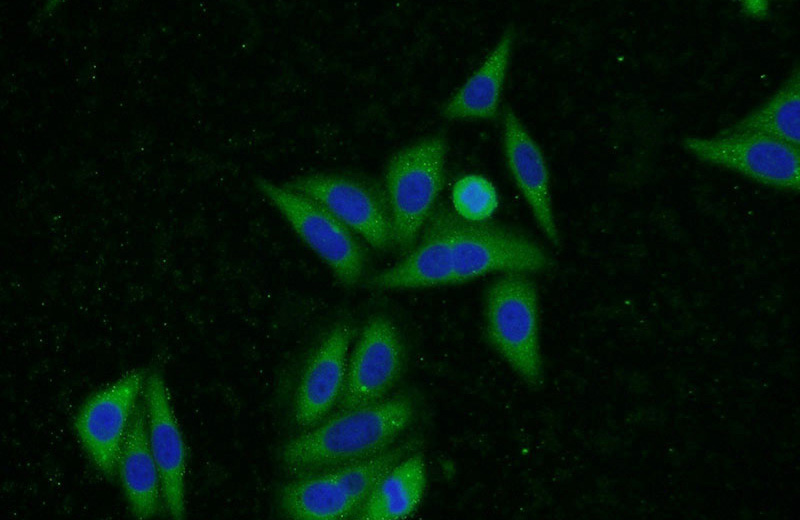 Immunofluorescent analysis of HepG2 cells using Catalog No:116658(Ubiquilin 2 Antibody) at dilution of 1:50 and Alexa Fluor 488-congugated AffiniPure Goat Anti-Rabbit IgG(H+L)