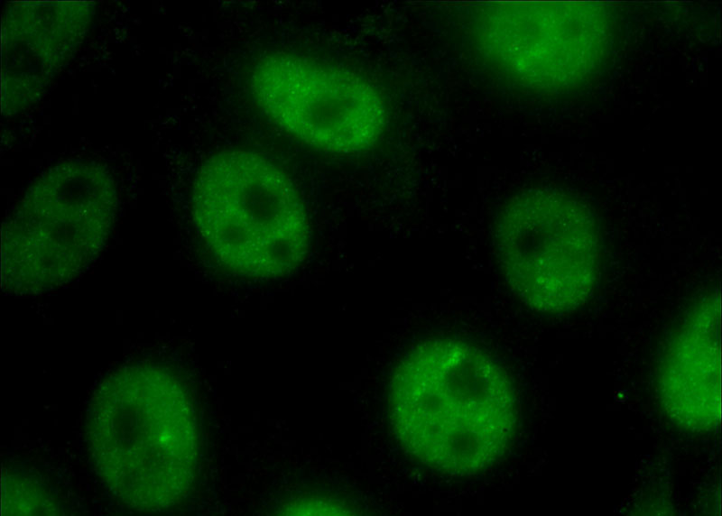 Immunofluorescent analysis of (10% Formaldehyde) fixed HeLa cells using Catalog No:115925(TDP-43 Antibody) at dilution of 1:400 and Alexa Fluor 488-congugated AffiniPure Goat Anti-Rabbit IgG(H+L)