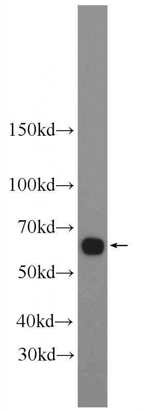 mouse skeletal muscle tissue were subjected to SDS PAGE followed by western blot with Catalog No:110773(FZD7 antibody) at dilution of 1:600