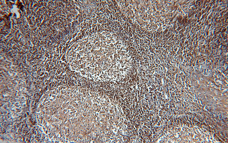 Immunohistochemical of paraffin-embedded human tonsil using Catalog No:111489(HMHA1 antibody) at dilution of 1:100 (under 10x lens)