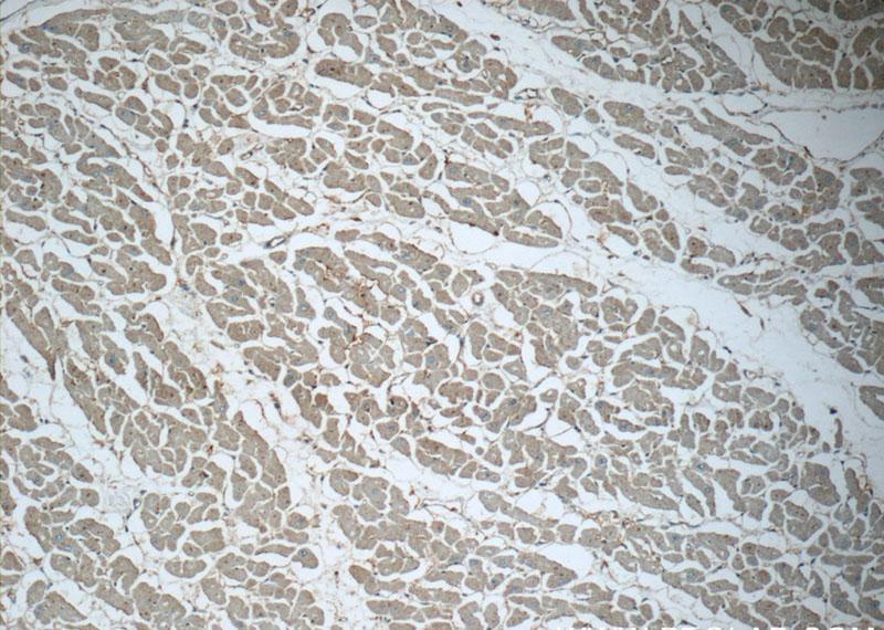 Immunohistochemistry of paraffin-embedded human heart tissue slide using Catalog No:114690 (RENIN-RECEPTOR, ATP6AP2 Antibody) at dilution of 1:50 (under 10x lens)