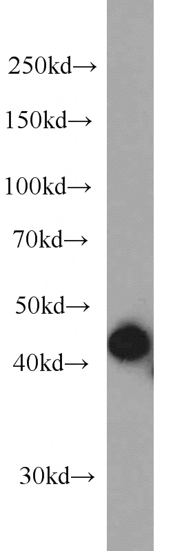 HepG2 cells were subjected to SDS PAGE followed by western blot with Catalog No:107263(HLA class I (HLA-A) antibody) at dilution of 1:500
