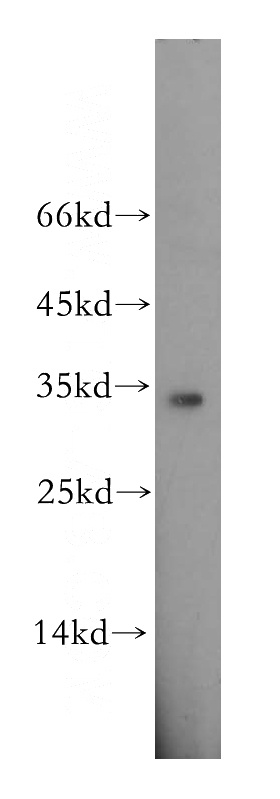 MCF7 cells were subjected to SDS PAGE followed by western blot with Catalog No:110181(EIF2B1 antibody) at dilution of 1:500
