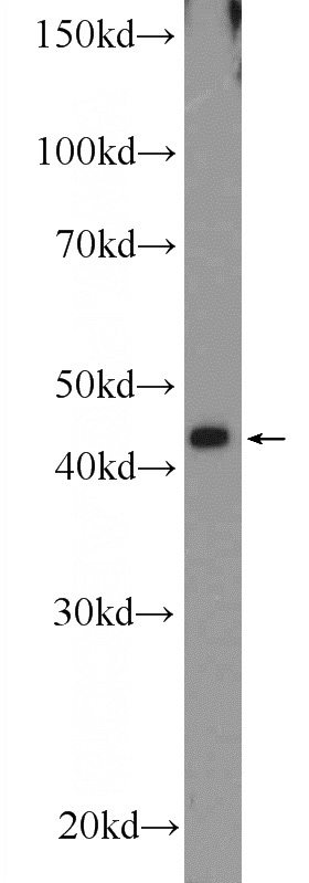 HEK-293 cells were subjected to SDS PAGE followed by western blot with Catalog No:115184(SH2D5 Antibody) at dilution of 1:300