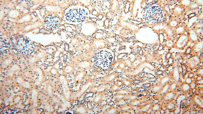 Immunohistochemical of paraffin-embedded human kidney using Catalog No:115404(SMU1 antibody) at dilution of 1:100 (under 10x lens)
