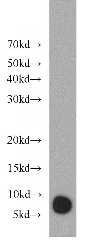 mouse eye tissue were subjected to SDS PAGE followed by western blot with Catalog No:111003(GNGT1 antibody) at dilution of 1:100