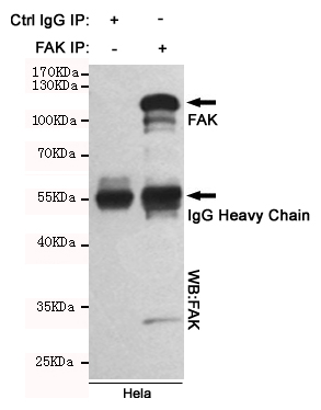 Immunoprecipitation analysis of Hela cell lysates using FAK mouse mAb.