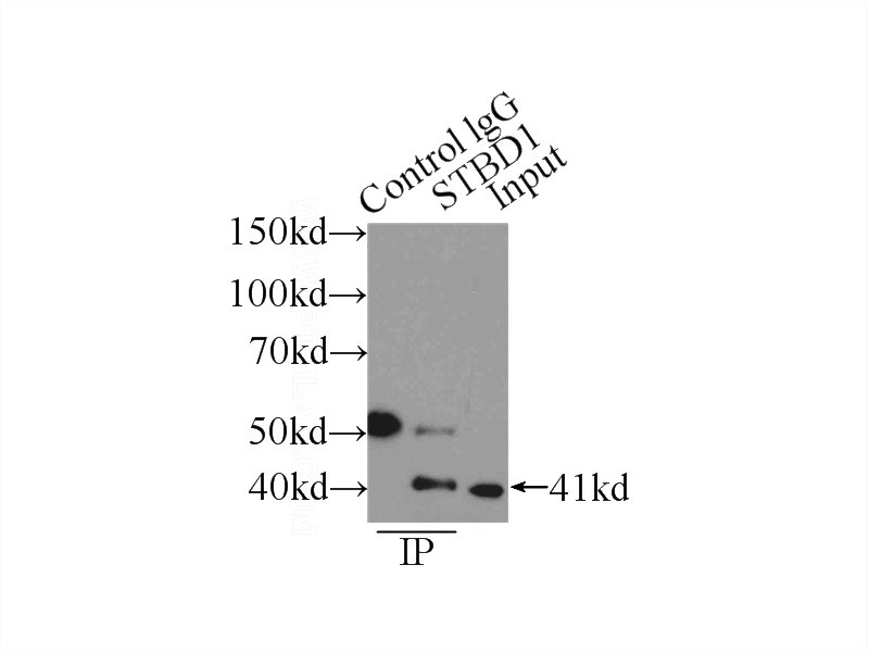 IP Result of anti-STBD1 (IP:Catalog No:115701, 4ug; Detection:Catalog No:115701 1:1000) with A549 cells lysate 1600ug.