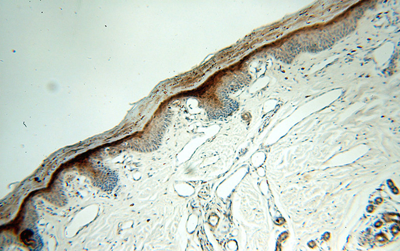 Immunohistochemical of paraffin-embedded human skin using Catalog No:115202(SERPINB13 antibody) at dilution of 1:100 (under 10x lens)