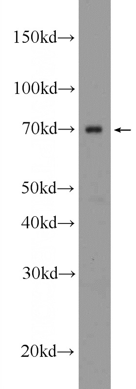 RAW 264.7 cells were subjected to SDS PAGE followed by western blot with Catalog No:111510(HNRNPL Antibody) at dilution of 1:600