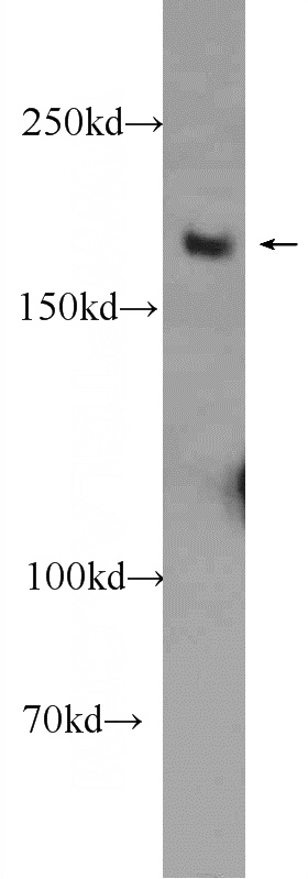 MCF-7 cells were subjected to SDS PAGE followed by western blot with Catalog No:116969(WRN Antibody) at dilution of 1:300