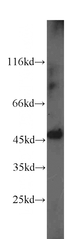mouse brain tissue were subjected to SDS PAGE followed by western blot with Catalog No:113886(PICK1 antibody) at dilution of 1:500