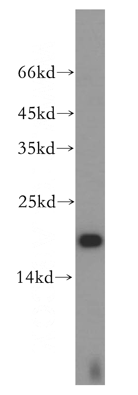 HeLa cells were subjected to SDS PAGE followed by western blot with Catalog No:116530(UBE2L3 antibody) at dilution of 1:500