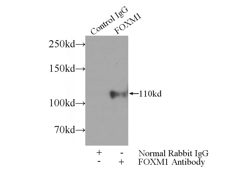 IP Result of anti-FOXM1 (IP:Catalog No:110702, 5ug; Detection:Catalog No:110702 1:700) with L02 cells lysate 1560ug.