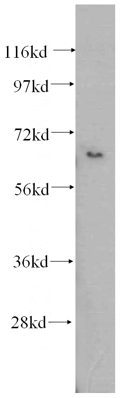 human kidney tissue were subjected to SDS PAGE followed by western blot with Catalog No:107853(AIFM3 antibody) at dilution of 1:500