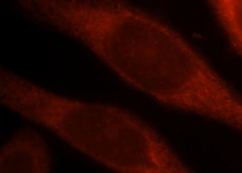 Immunofluorescent analysis of Hela cells, using ADSL antibody Catalog No:107785 at 1:25 dilution and Rhodamine-labeled goat anti-rabbit IgG (red).