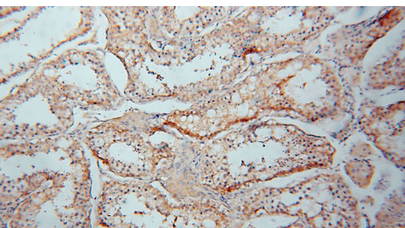 Immunohistochemical of paraffin-embedded human testis using Catalog No:109415(CMIP antibody) at dilution of 1:50 (under 10x lens)