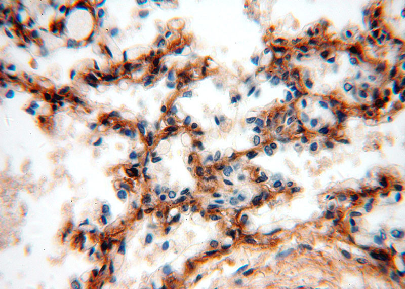 Immunohistochemical of paraffin-embedded human lung using Catalog No:113900(PIH1D1 antibody) at dilution of 1:100 (under 40x lens)
