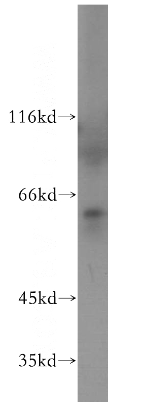 COLO 320 cells were subjected to SDS PAGE followed by western blot with Catalog No:112537(MGAT3 antibody) at dilution of 1:500