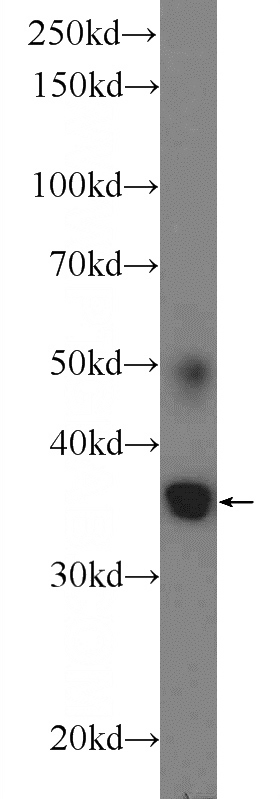 mouse brain tissue were subjected to SDS PAGE followed by western blot with Catalog No:108326(C2orf28 Antibody) at dilution of 1:300