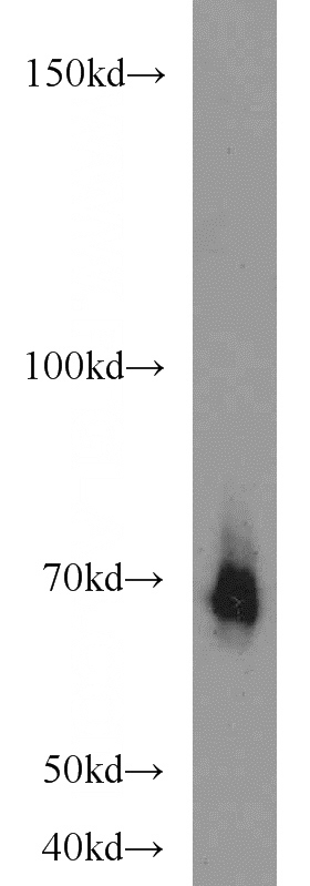 mouse brain tissue were subjected to SDS PAGE followed by western blot with Catalog No:107889(ADRA1B antibody) at dilution of 1:1000
