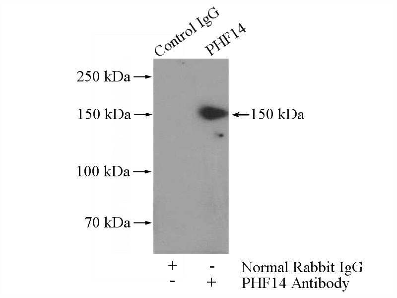 IP Result of anti-PHF14 (IP:Catalog No:113808, 4ug; Detection:Catalog No:113808 1:500) with HEK-293 cells lysate 1200ug.