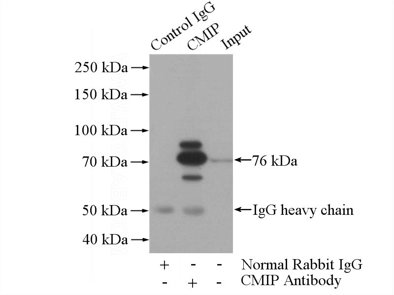 IP Result of anti-CMIP (IP:Catalog No:109415, 4ug; Detection:Catalog No:109415 1:300) with Raji cells lysate 2000ug.