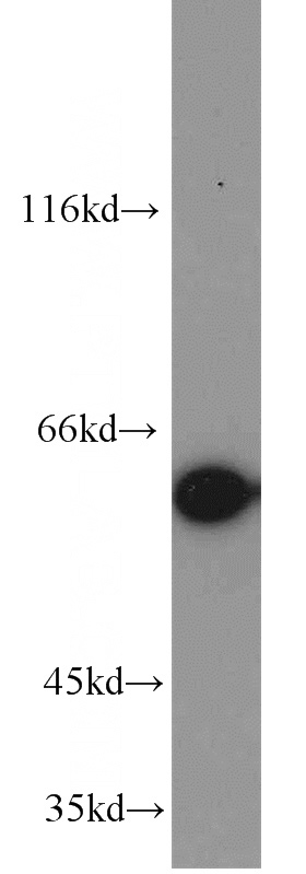 HeLa cells were subjected to SDS PAGE followed by western blot with Catalog No:108091(ANXA11 antibody) at dilution of 1:1000