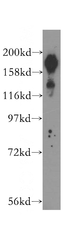 HEK-293 cells were subjected to SDS PAGE followed by western blot with Catalog No:117108(BCOR antibody) at dilution of 1:400