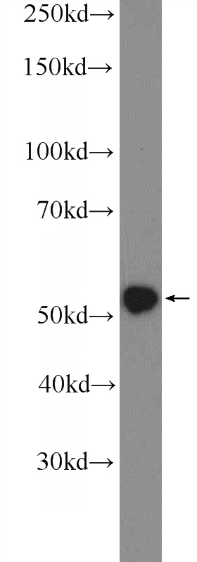 HEK-293 cells were subjected to SDS PAGE followed by western blot with Catalog No:116230(TRAF3 Antibody) at dilution of 1:600