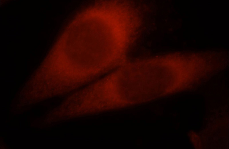 Immunofluorescent analysis of Hela cells, using PLOD2 antibody Catalog No:114005 at 1:25 dilution and Rhodamine-labeled goat anti-rabbit IgG (red).