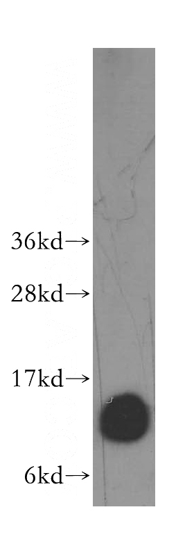 human brain tissue were subjected to SDS PAGE followed by western blot with Catalog No:110143(DYNLT3 antibody) at dilution of 1:500