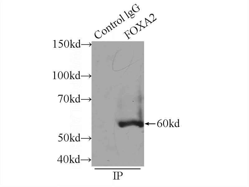IP Result of anti-FOXA2 (IP:Catalog No:110746, 3ug; Detection:Catalog No:110746 1:300) with HepG2 cells lysate 1920ug.