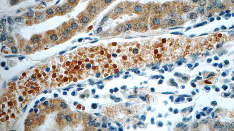 Immunohistochemistry of paraffin-embedded human stomach tissue slide using Catalog No:115425(SMAP1 Antibody) at dilution of 1:50 (under 40x lens)