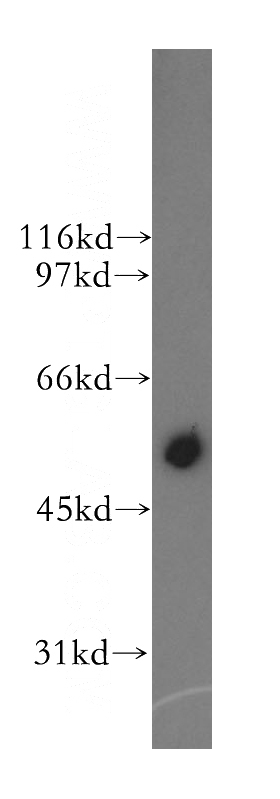 mouse skeletal muscle tissue were subjected to SDS PAGE followed by western blot with Catalog No:109696(CYP2J2 antibody) at dilution of 1:500