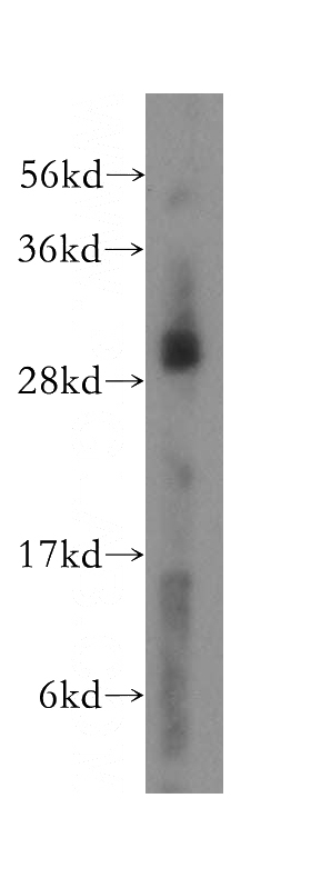 HEK-293 cells were subjected to SDS PAGE followed by western blot with Catalog No:112809(MRPL10 antibody) at dilution of 1:500