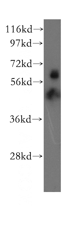 mouse testis tissue were subjected to SDS PAGE followed by western blot with Catalog No:110226(EHD4 antibody) at dilution of 1:500
