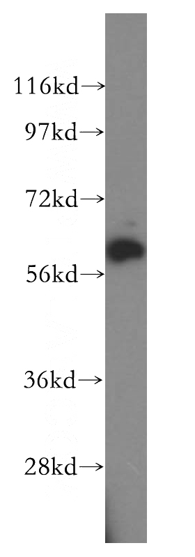 Jurkat cells were subjected to SDS PAGE followed by western blot with Catalog No:111402(HEMGN antibody) at dilution of 1:500
