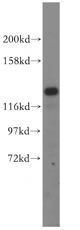 HEK-293 cells were subjected to SDS PAGE followed by western blot with Catalog No:109832(DDX46 antibody) at dilution of 1:500