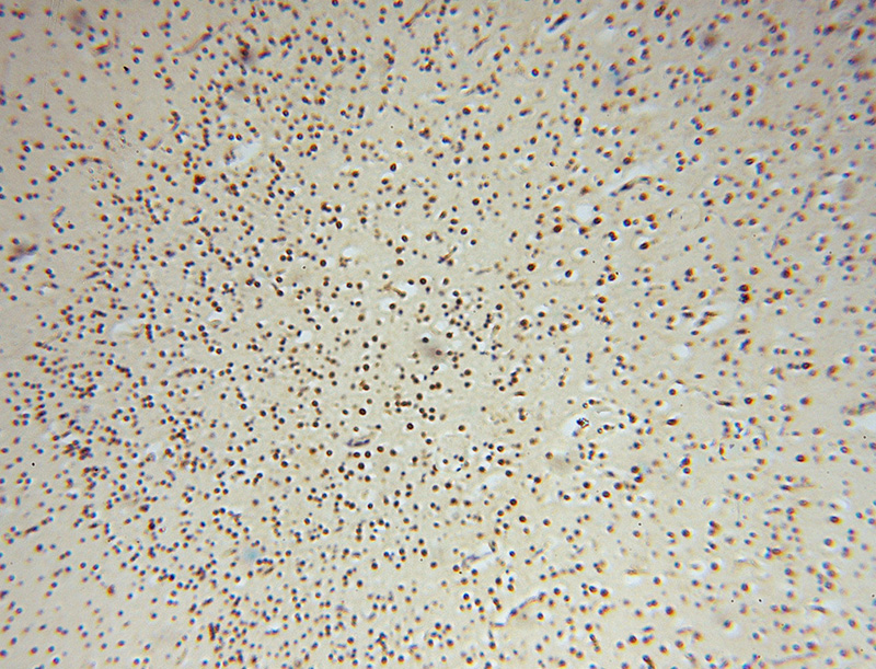 Immunohistochemical of paraffin-embedded human brain using Catalog No:114731(RNASEH2C antibody) at dilution of 1:50 (under 10x lens)