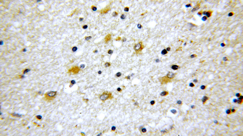 Immunohistochemical of paraffin-embedded human brain using Catalog No:115944(TNR-Specific antibody) at dilution of 1:100 (under 40x lens)