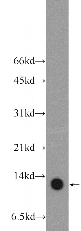 PC-3 cells were subjected to SDS PAGE followed by western blot with Catalog No:108659(C14orf156 Antibody) at dilution of 1:600