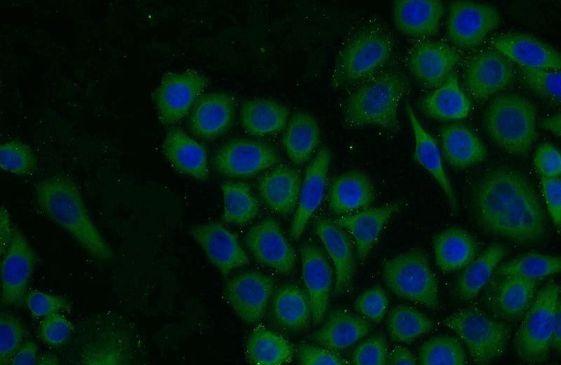 Immunofluorescent analysis of PC-3 cells using Catalog No:116403(TROVE2 Antibody) at dilution of 1:25 and Alexa Fluor 488-congugated AffiniPure Goat Anti-Rabbit IgG(H+L)