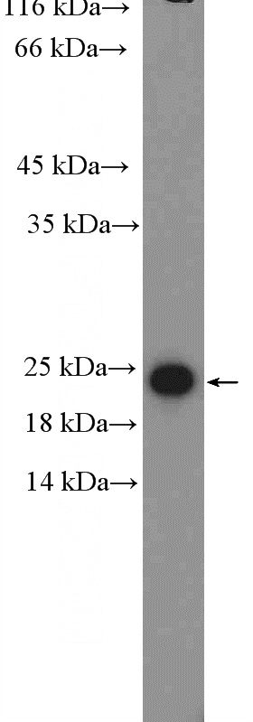 HepG2 cells were subjected to SDS PAGE followed by western blot with Catalog No:114886(RPL29 Antibody) at dilution of 1:600