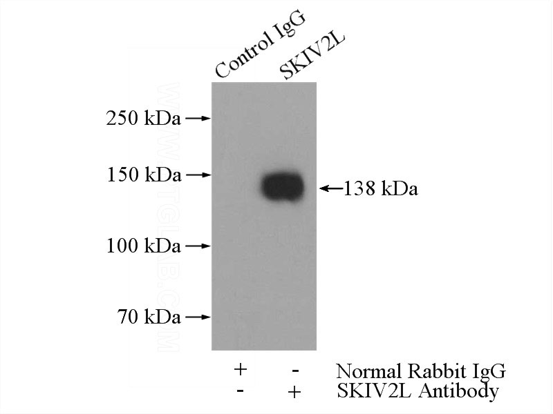 IP Result of anti-SKIV2L (IP:Catalog No:115258, 4ug; Detection:Catalog No:115258 1:600) with HepG2 cells lysate 3200ug.