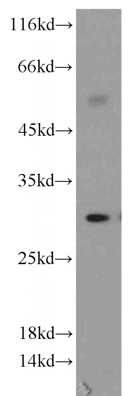 HepG2 cells were subjected to SDS PAGE followed by western blot with Catalog No:111428(HLA-DRB5 antibody) at dilution of 1:500