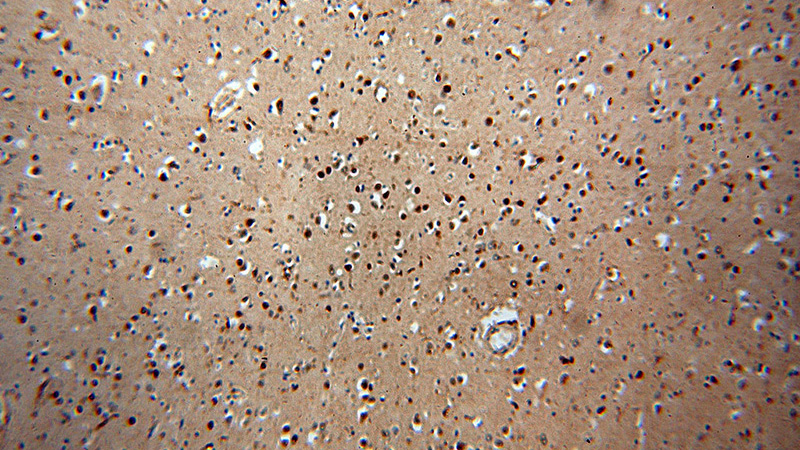 Immunohistochemical of paraffin-embedded human brain using Catalog No:113317(NPAS1 antibody) at dilution of 1:50 (under 10x lens)