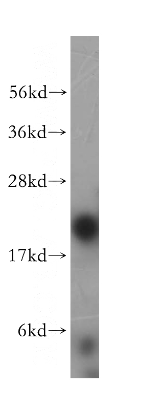 Raji cells were subjected to SDS PAGE followed by western blot with Catalog No:112286(PSMB9 antibody) at dilution of 1:400