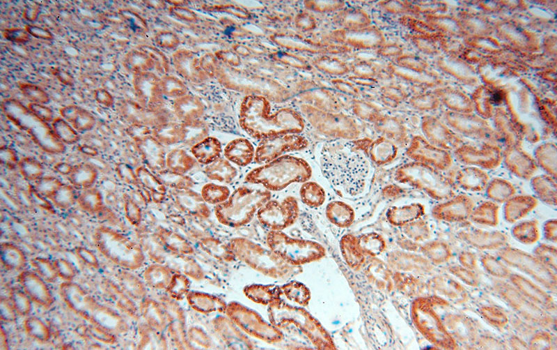 Immunohistochemical of paraffin-embedded human kidney using Catalog No:113066(NDUFAF1 antibody) at dilution of 1:50 (under 10x lens)